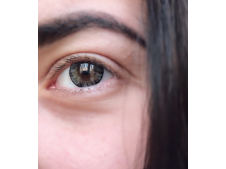 Синдром сухого ока при носінні контактних лінз